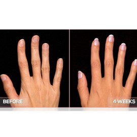 Perfect Formula Ruby Pink Gel Coat - Nail Strengthener, Keratin Nail Treatment, Gemstone Pink Gel Nail Polish - Nail Strengthener for Damaged Nails - Made In The USA .60 fl oz. Perfect Formula Ruby Pink Gel Coat - Nail Strengthener, Keratin Nail Treatment, Gemstone Pink Gel Nail Polish - Nail Strengthener for Damaged Nails - Made In The USA .60 fl oz.