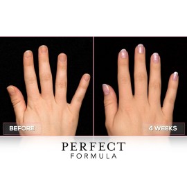 Perfect Formula Ruby Pink Gel Coat - Nail Strengthener, Keratin Nail Treatment, Gemstone Pink Gel Nail Polish - Nail Strengthener for Damaged Nails - Made In The USA .60 fl oz. Perfect Formula Ruby Pink Gel Coat - Nail Strengthener, Keratin Nail Treatment, Gemstone Pink Gel Nail Polish - Nail Strengthener for Damaged Nails - Made In The USA .60 fl oz.