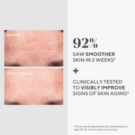 Murad Retinol Youth Renewal Serum - Rapid-Action Retinol Treatment for Face and Neck - Visibly Reduces Lines and Wrinkles, Firms and Smooths Skin, Nightly Use Formula - 1.0 Fl Oz Murad Retinol Youth Renewal Serum - Rapid-Action Retinol Treatment for Face and Neck - Visibly Reduces Lines and Wrinkles, Firms and Smooths Skin, Nightly Use Formula - 1.0 Fl Oz