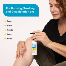 Pure Relief Arnica Cream Bruise Relief Lotion for Bruising and Swelling On Skin | Bruise Cream Extra Strength Vitamin K Cream | Moisturizing Arnica Bruise Formula Skin Care Gel W/Collagen, 4 Fl Oz