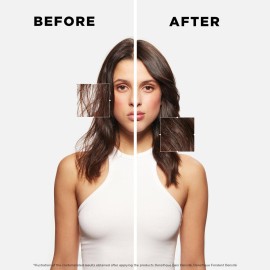 KRASTASE Densifique Densit Shampoo, Thickening & Strengthening Shampoo, Removes Build-Up & Adds Shine with Hyaluronic Acid for Fine, Thin & Thinning Hair, 8.5 Fl Oz