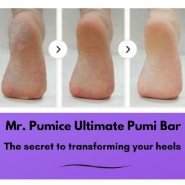 Mr. Pumice Ultimate PUMI Bar 2-in-1 Dual Grit (Medium + Coarse) Callus Remover, Pedicure Stone & Ped File Scrubber for Smooth Feet and Heels (4 Pack) Mr. Pumice Ultimate PUMI Bar 2-in-1 Dual Grit (Medium + Coarse) Callus Remover, Pedicure Stone & Ped File Scrubber for Smooth Feet and Heels (4 Pack)