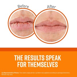 O\'Keeffe\'s Lip Repair Unscented Lip Balm for Dry, Cracked Lips - Stick (3 Pack) - Moisturizer for Very Dry Lips O\'Keeffe\'s Lip Repair Unscented Lip Balm for Dry, Cracked Lips - Stick (3 Pack) - Moisturizer for Very Dry Lips
