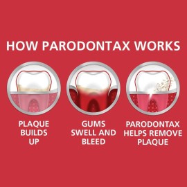 Parodontax Toothpaste for Bleeding Gums, Gingivitis Treatment and Cavity Prevention, Clean mint - 3.4 Ounces
