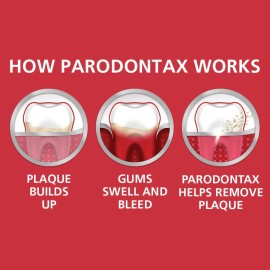 Parodontax Whitening Toothpaste for Bleeding Gums, Teeth Whitening and Gingivitis Treatment - 3.4 Ounces