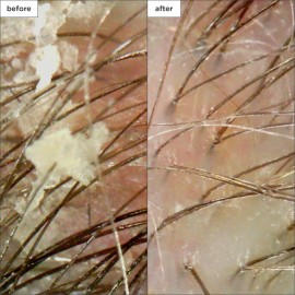 Briogeo Scalp Revival Charcoal + Coconut Oil Micro-Exfoliating Shampoo, Treatment for Dry & Itchy Scalp, Clarifying Shampoo for Build Up, Scalp Scrub for Oily Scalp, Vegan, Cruelty-Free, 8 fl oz