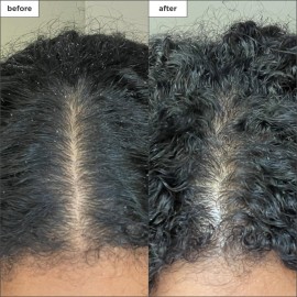 Briogeo Scalp Revival Charcoal + Coconut Oil Micro-Exfoliating Shampoo, Treatment for Dry & Itchy Scalp, Clarifying Shampoo for Build Up, Scalp Scrub for Oily Scalp, Vegan, Cruelty-Free, 8 fl oz