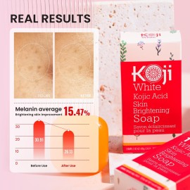 Koji White Pure Kojic Acid Soap | Glycerin Soap Bar for Gentle Skin Brightening and Exfoliation with Tea Tree, Coconut Oil, Hyaluronic Acid & Vitamin C, Vegan, 2.82 oz Koji White Pure Kojic Acid Soap | Glycerin Soap Bar for Gentle Skin Brightening and Exfoliation with Tea Tree, Coconut Oil, Hyaluronic Acid & Vitamin C, Vegan, 2.82 oz