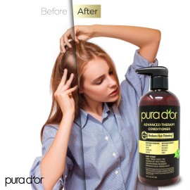 PURA D\'OR Advanced Therapy Conditioner (16oz) For Increased Moisture, Strength, Volume & Texture, No Sulfates, Contains Argan Oil & Biotin, All Hair Types, Men & Women (Packaging May Vary)