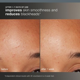 Dermalogica Daily Microfoliant, Face Exfoliator Scrub Powder with Salicylic Acid and Papaya Enzyme, Achieve Brighter, Smoother Skin Daily, 2.6 Oz Dermalogica Daily Microfoliant, Face Exfoliator Scrub Powder with Salicylic Acid and Papaya Enzyme, Achieve Brighter, Smoother Skin Daily, 2.6 Oz