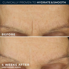 RoC Retinol Correxion Max Daily Hydration Anti-Aging Face Moisturizer with Hyaluronic Acid, Oil Free Skin Care Cream for Fine Lines, Dark Spots, Post-Acne Scars, 1.7 Ounces (Packaging May Vary) RoC Retinol Correxion Max Daily Hydration Anti-Aging Face Moisturizer with Hyaluronic Acid, Oil Free Skin Care Cream for Fine Lines, Dark Spots, Post-Acne Scars, 1.7 Ounces (Packaging May Vary)