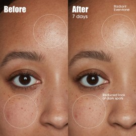 Sunday Riley C.E.O. 15% Vitamin C Brightening Serum, Orange, 1.0 Fl oz(pack of 1) Sunday Riley C.E.O. 15% Vitamin C Brightening Serum, Orange, 1.0 Fl oz(pack of 1)