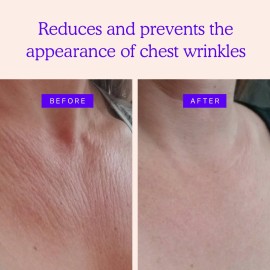 BLUMBODY Chest Wrinkle Pads - Anti-Wrinkle Silicone Patches Skin Firming & Smoothing - Reusable Overnight Chest Pads - Anti-Aging Crepe Erase Pads - Neck & Dcollet (1-Month Supply)