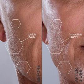 Michael Todd Beauty - Sonicsmooth - SONIC Technology Dermaplaning Tool - 2 in 1 Womens Facial Exfoliation & Peach Fuzz Hair Removal System with 8 Weeks of Dermaplaning Blades