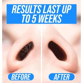 KENASHII Nose Wax Kit | 100 g Wax, 24 Applicators | Hair Removal Kit for Men and Women | Includes Balm Wipes and Mustache Guards | Lasts up to 5 Weeks KENASHII Nose Wax Kit | 100 g Wax, 24 Applicators | Hair Removal Kit for Men and Women | Includes Balm Wipes and Mustache Guards | Lasts up to 5 Weeks