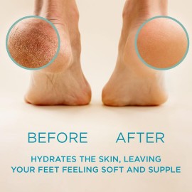 Lee Beauty Professional Callus Remover for Feet - Extra Strength Gel & Rasp Foot File Kit - Original Formula for Dead Skin Remover for Cracked Heels & Dry Skin-Pedicure Supplies for Smooth Foot - 8 Oz Lee Beauty Professional Callus Remover for Feet - Extra Strength Gel & Rasp Foot File Kit - Original Formula for Dead Skin Remover for Cracked Heels & Dry Skin-Pedicure Supplies for Smooth Foot - 8 Oz