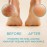 Lee Beauty Professional Callus Remover for Feet - Extra Strength Gel & Rasp Foot File Kit - Original Formula for Dead Skin Remover for Cracked Heels & Dry Skin-Pedicure Supplies for Smooth Foot - 8 Oz