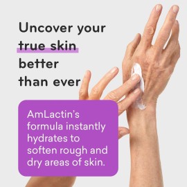AmLactin Ultra Smoothing - 4.9 oz Body & Hand Cream with 15% Lactic Acid - Exfoliator and Moisturizer for Rough and Bumpy Dry Skin (Packaging May Vary) AmLactin Ultra Smoothing - 4.9 oz Body & Hand Cream with 15% Lactic Acid - Exfoliator and Moisturizer for Rough and Bumpy Dry Skin (Packaging May Vary)