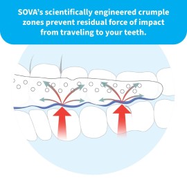 SOVA Aero Night Guard - 1.6mm Thin - Custom-Molded Fit - Protects Against Nighttime Teeth Grinding & Clenching - FSA/HSA Eligible - Odor & Taste Free - Remoldable Up to 20 Times - Non Toxic SOVA Aero Night Guard - 1.6mm Thin - Custom-Molded Fit - Protects Against Nighttime Teeth Grinding & Clenching - FSA/HSA Eligible - Odor & Taste Free - Remoldable Up to 20 Times - Non Toxic
