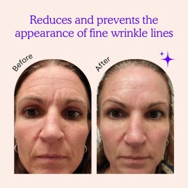 BLUMBODY Face & Forehead Wrinkle Patches - Anti Wrinkle Facial Patches to Smooth Eye, Mouth, Forehead Wrinkles - Non-Silicone Face Tape for Fine Wrinkles between Eyes & Face - Patches (30 day supply) BLUMBODY Face & Forehead Wrinkle Patches - Anti Wrinkle Facial Patches to Smooth Eye, Mouth, Forehead Wrinkles - Non-Silicone Face Tape for Fine Wrinkles between Eyes & Face - Patches (30 day supply)