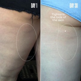 MALYS Cosmetics B-TIGHT Leave-On Cellulite Mask - Reduces The Appearance Of Cellulite - Visibly Tightens The Skin In The Butt Area