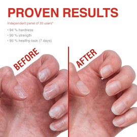 Probelle Nail Strengthener and growth, Natural Nail Strengthening Clear Nail Polish Repair Treatment, Nail Growth & Conditioning, Stops Splits, Chips, Cracks & Strengthens Damaged and Thin Nails Probelle Nail Strengthener and growth, Natural Nail Strengthening Clear Nail Polish Repair Treatment, Nail Growth & Conditioning, Stops Splits, Chips, Cracks & Strengthens Damaged and Thin Nails