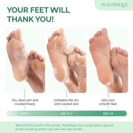 PLANTIFIQUE Foot Peeling Mask (2 Pairs) - Peeling Foot Mask Dermatologically Tested Repairs Heels & Removes Dry Dead Skin for Baby Soft Feet - Exfoliating Foot Peel Mask for Dry Cracked Feet (Peach) PLANTIFIQUE Foot Peeling Mask (2 Pairs) - Peeling Foot Mask Dermatologically Tested Repairs Heels & Removes Dry Dead Skin for Baby Soft Feet - Exfoliating Foot Peel Mask for Dry Cracked Feet (Peach)
