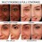 IT Cosmetics Bye Bye Under Eye Full Coverage Concealer - for Dark Circles, Fine Lines, Redness & Discoloration - Waterproof - Natural Finish - 20.0 Medium (N), 0.4 fl oz