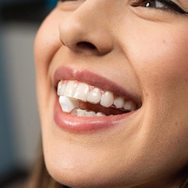 Movemints Clear Aligner Mints - Patented, Edible Alternative to Chewies - Freshen Breath and Improve Dry Mouth with Xylitol - Spearmint (3 Pack) Movemints Clear Aligner Mints - Patented, Edible Alternative to Chewies - Freshen Breath and Improve Dry Mouth with Xylitol - Spearmint (3 Pack)
