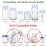 Maymom Travel Bottle Caps Compatible with Avent Bottle; Cap Replace Avent Natural Bottle Screw Ring n Sealing Disc; Fit Avent Anti-Colic Polypropylene, Glass Bottle, Avent PP, Bottle Lids Replacement
