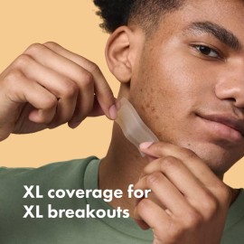 Mighty Patch Surface from Hero Cosmetics - Hydrocolloid Spot Patch for Body, Cheek, Forehead, and Chin, Vegan-friendly (10 Count) Mighty Patch Surface from Hero Cosmetics - Hydrocolloid Spot Patch for Body, Cheek, Forehead, and Chin, Vegan-friendly (10 Count)