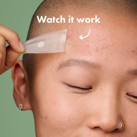 Mighty Patch Surface from Hero Cosmetics - Hydrocolloid Spot Patch for Body, Cheek, Forehead, and Chin, Vegan-friendly (10 Count) Mighty Patch Surface from Hero Cosmetics - Hydrocolloid Spot Patch for Body, Cheek, Forehead, and Chin, Vegan-friendly (10 Count)