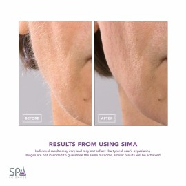 SPA SCIENCES - SIMA Patented Dermaplane Razor for Women Face - Painless 2-in-1 Facial Exfoliation & Peach Fuzz Hair Removal - Anti-Aging - 3 Speeds - Rechargeable - 7 Weeks Treatment SPA SCIENCES - SIMA Patented Dermaplane Razor for Women Face - Painless 2-in-1 Facial Exfoliation & Peach Fuzz Hair Removal - Anti-Aging - 3 Speeds - Rechargeable - 7 Weeks Treatment