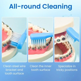Y-Kelin V-Shaped Orthodontic Toothbrush for Braces Brackets 4 Count (Pack of 1) Soft Bristle with Inter Dental Brush Y-Kelin V-Shaped Orthodontic Toothbrush for Braces Brackets 4 Count (Pack of 1) Soft Bristle with Inter Dental Brush