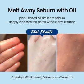 coxir ULTRA HYALURONIC CLEANSING OIL l Gentle Korean Facial Cleanser, Blackhead, Makeup Removal with Hyaluronic Acid, Plant-based oils, No Mineral Oil [5.07 Fl.oz(pack of 1)]