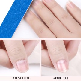 KISEER Mini Nail Files Bulk, 100 Pcs Disposable Double Sided Emery Boards Travel Size for Men, Women, Kids (2 Inch) KISEER Mini Nail Files Bulk, 100 Pcs Disposable Double Sided Emery Boards Travel Size for Men, Women, Kids (2 Inch)