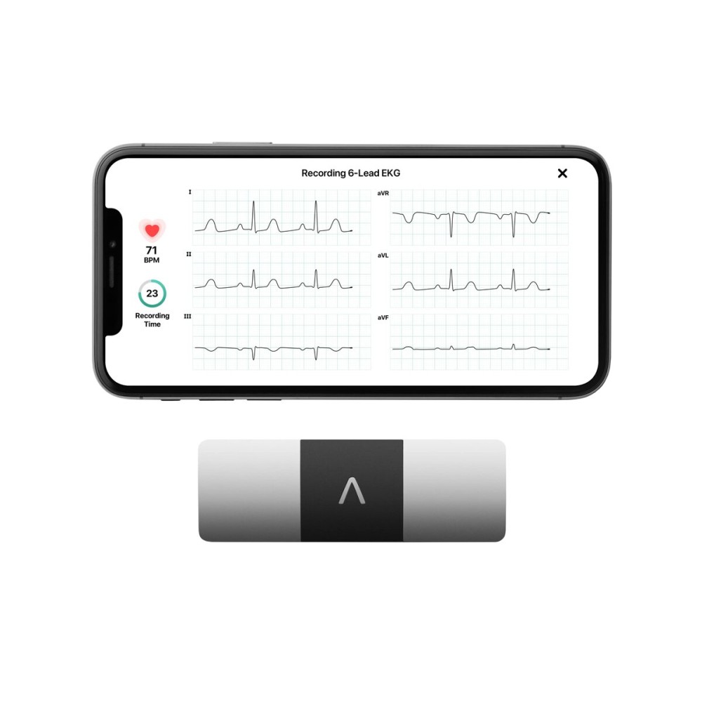KardiaMobile 6-Lead Personal EKG Monitor - Six Views of The Heart - Detects AFib and Irregular Arrhythmias - Instant Results in 30 Seconds - Works with Most Smartphones - FSA/HSA Eligible KardiaMobile 6-Lead Personal EKG Monitor - Six Views of The Heart - Detects AFib and Irregular Arrhythmias - Instant Results in 30 Seconds - Works with Most Smartphones - FSA/HSA Eligible