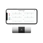 KardiaMobile 6-Lead Personal EKG Monitor - Six Views of The Heart - Detects AFib and Irregular Arrhythmias - Instant Results in 30 Seconds - Works with Most Smartphones - FSA/HSA Eligible