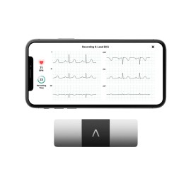 KardiaMobile 6-Lead Personal EKG Monitor - Six Views of The Heart - Detects AFib and Irregular Arrhythmias - Instant Results in 30 Seconds - Works with Most Smartphones - FSA/HSA Eligible KardiaMobile 6-Lead Personal EKG Monitor - Six Views of The Heart - Detects AFib and Irregular Arrhythmias - Instant Results in 30 Seconds - Works with Most Smartphones - FSA/HSA Eligible