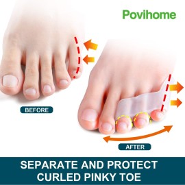 Povihome 10 Pack Pinky Toe Separator and Protectors, Triple Gel Toe Separators for Overlapping Toe, Curled Pinky Toes Separate and Protect Povihome 10 Pack Pinky Toe Separator and Protectors, Triple Gel Toe Separators for Overlapping Toe, Curled Pinky Toes Separate and Protect
