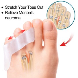 Povihome 10 Pack Pinky Toe Separator and Protectors, Triple Gel Toe Separators for Overlapping Toe, Curled Pinky Toes Separate and Protect Povihome 10 Pack Pinky Toe Separator and Protectors, Triple Gel Toe Separators for Overlapping Toe, Curled Pinky Toes Separate and Protect