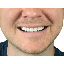 Instant Smile Comfort Fit Flex - Natural Shade - Upper Veneer Cosmetic Teeth Instant Smile Comfort Fit Flex - Natural Shade - Upper Veneer Cosmetic Teeth