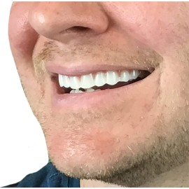 Instant Smile Comfort Fit Flex - Natural Shade - Upper Veneer Cosmetic Teeth Instant Smile Comfort Fit Flex - Natural Shade - Upper Veneer Cosmetic Teeth