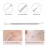 Professional Blackhead and Blemish Remover -Pimple Comedone Removal 2-in-1 Extractor Tool -by La Chat (1 Pack)