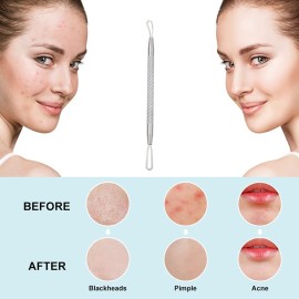 Professional Blackhead and Blemish Remover -Pimple Comedone Removal 2-in-1 Extractor Tool -by La Chat (1 Pack)