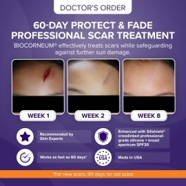 Advanced Scar Treatment with Silishield & SPF 30 50g - Made in the USA, Fast-Drying, Water-Resistant Silicone Scar Gel - Surgeon Recommended for New & Old Scars - Suitable for Children Over 6 Months Advanced Scar Treatment with Silishield & SPF 30 50g - Made in the USA, Fast-Drying, Water-Resistant Silicone Scar Gel - Surgeon Recommended for New & Old Scars - Suitable for Children Over 6 Months