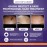 Advanced Scar Treatment with Silishield & SPF 30 50g - Made in the USA, Fast-Drying, Water-Resistant Silicone Scar Gel - Surgeon Recommended for New & Old Scars - Suitable for Children Over 6 Months