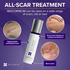 Advanced Scar Treatment with Silishield & SPF 30 50g - Made in the USA, Fast-Drying, Water-Resistant Silicone Scar Gel - Surgeon Recommended for New & Old Scars - Suitable for Children Over 6 Months Advanced Scar Treatment with Silishield & SPF 30 50g - Made in the USA, Fast-Drying, Water-Resistant Silicone Scar Gel - Surgeon Recommended for New & Old Scars - Suitable for Children Over 6 Months