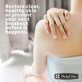 De La Cruz Sulfur Ointment - Cystic Acne Treatment for Face and Body - Daily 10 Min Spot Treatment Mask - Safe and Effective Game Changing Hormonal Acne Treatment That Clears Up Pimples 5.5 OZ. De La Cruz Sulfur Ointment - Cystic Acne Treatment for Face and Body - Daily 10 Min Spot Treatment Mask - Safe and Effective Game Changing Hormonal Acne Treatment That Clears Up Pimples 5.5 OZ.