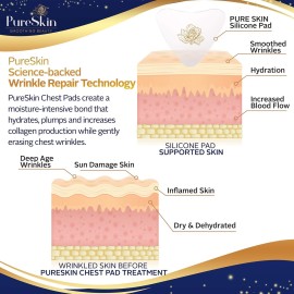 PureSkin Chest Wrinkle Pads-4 PACK -Decollete Anti Wrinkle Chest Pads | Silicone Patches for Wrinkles | Chest Wrinkles from Side Sleeping | Chest Wrinkles | Silicone Chest Pads PureSkin Chest Wrinkle Pads-4 PACK -Decollete Anti Wrinkle Chest Pads | Silicone Patches for Wrinkles | Chest Wrinkles from Side Sleeping | Chest Wrinkles | Silicone Chest Pads